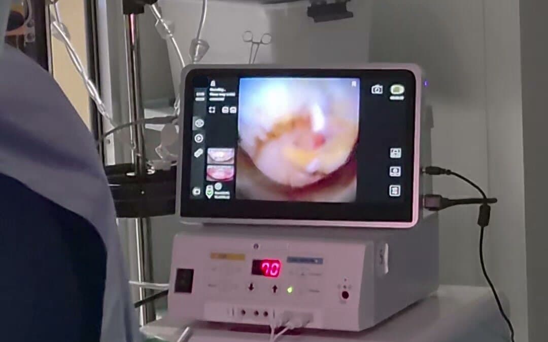 TISE portable touch console on the cart in the operating room, showing the live view