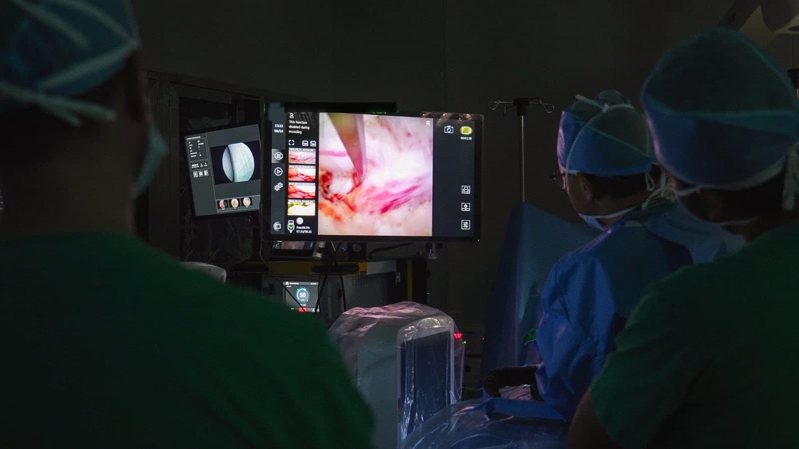 Surgical team watching the TISE Full HD view on the operating room's wide-screen display